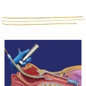 ENDOTRACHEAL TUBE INTRODUCER